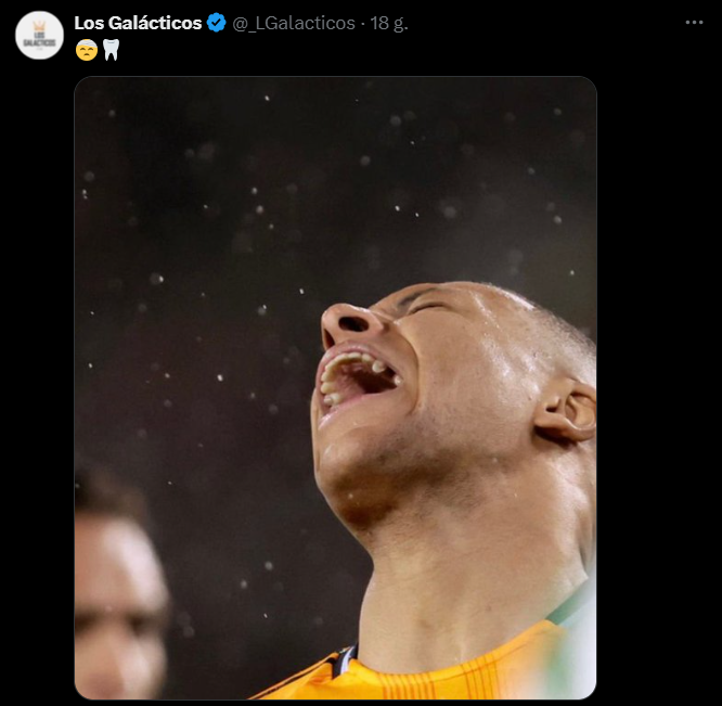 Kylian Mbappe i jego ''ZĄB'' po niedawnym zabiegu!